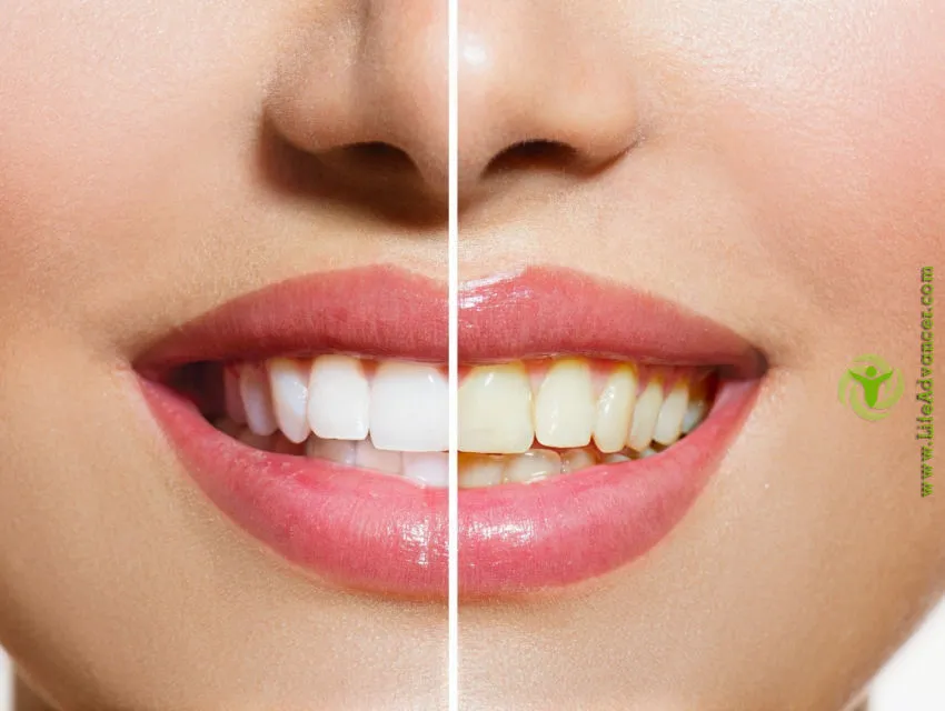 /img/26127-maintain-white-teeth.webp