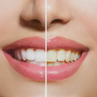 /img/26127-maintain-white-teeth.webp