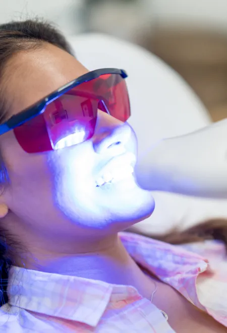 26128 teeth whitening comparison