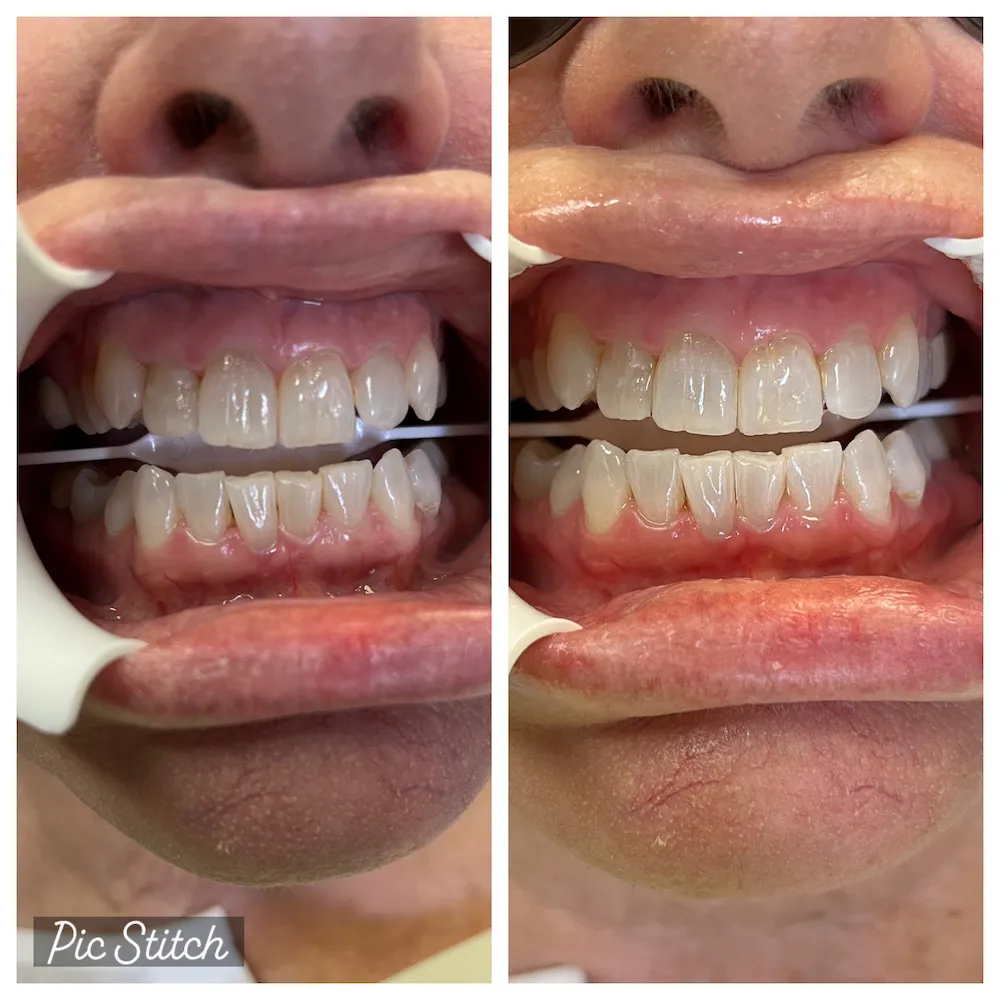26132 florida teeth whitening toothpaste