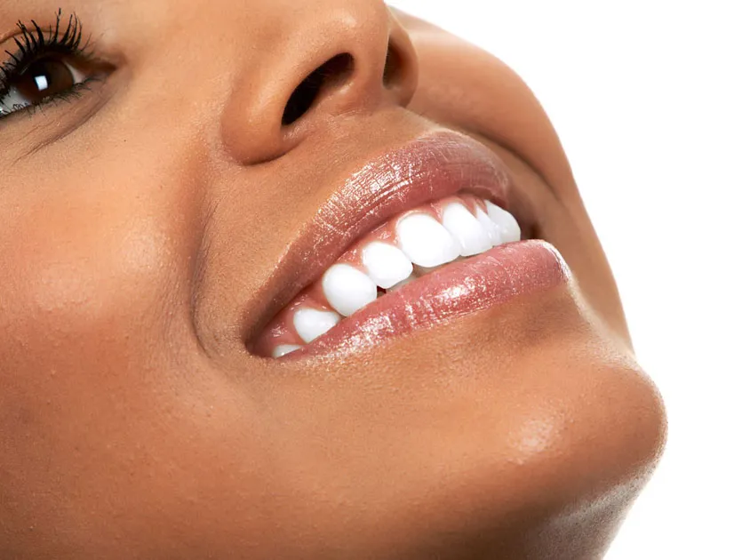 26133 zoom teeth whitening houston clinic