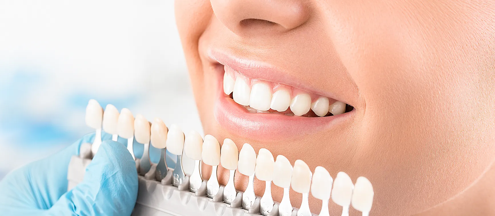 26136 teeth whitening meridian id 3