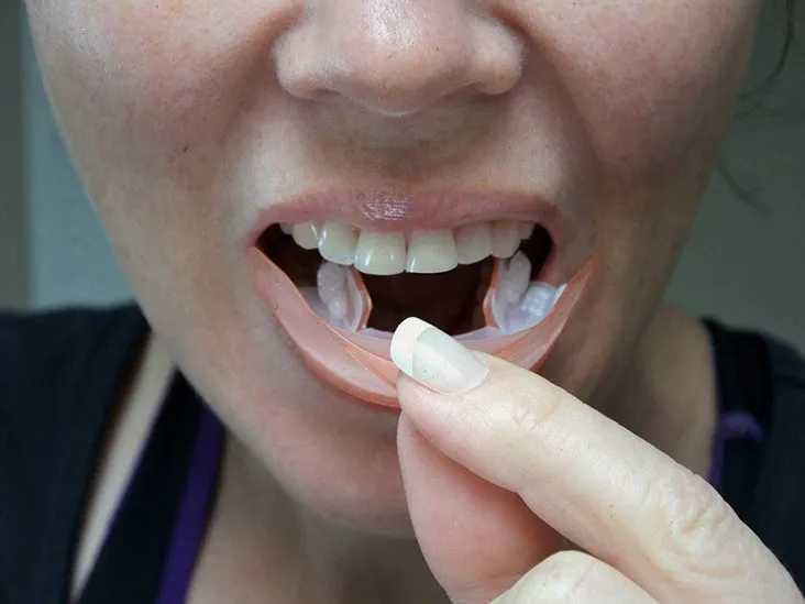 /img/26138-maintaining-teeth-whitening.webp