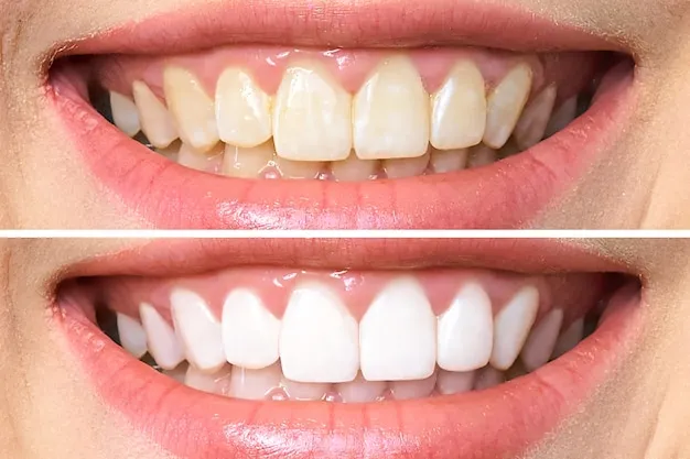 /img/26140-healthy-smile.webp