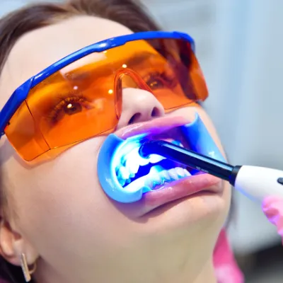 26142 hydrogen peroxide teeth