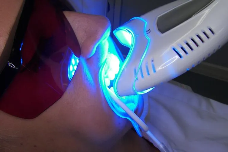 /img/26142-laser-whitening-before-after.webp