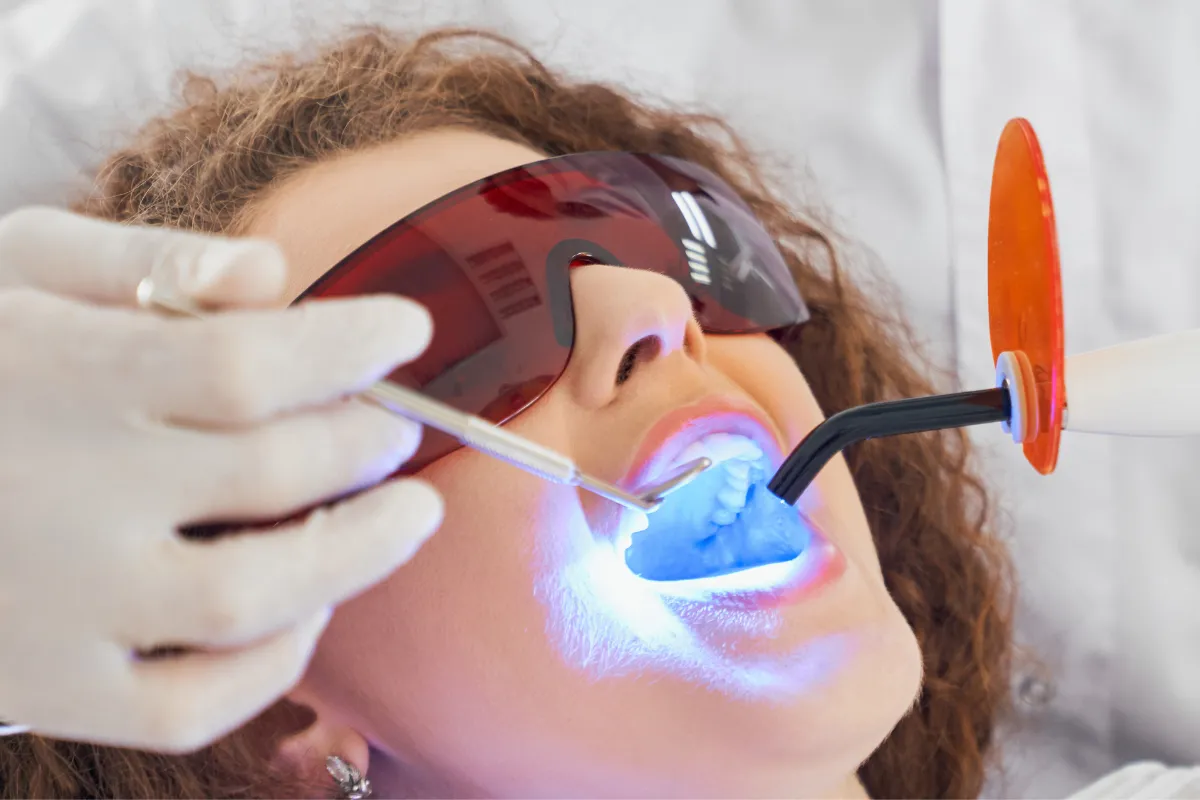 26142 laser whitening results