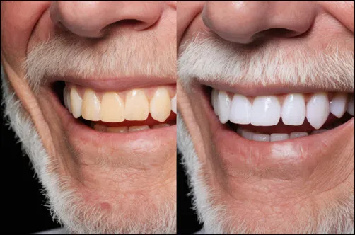 26143 dental checkup