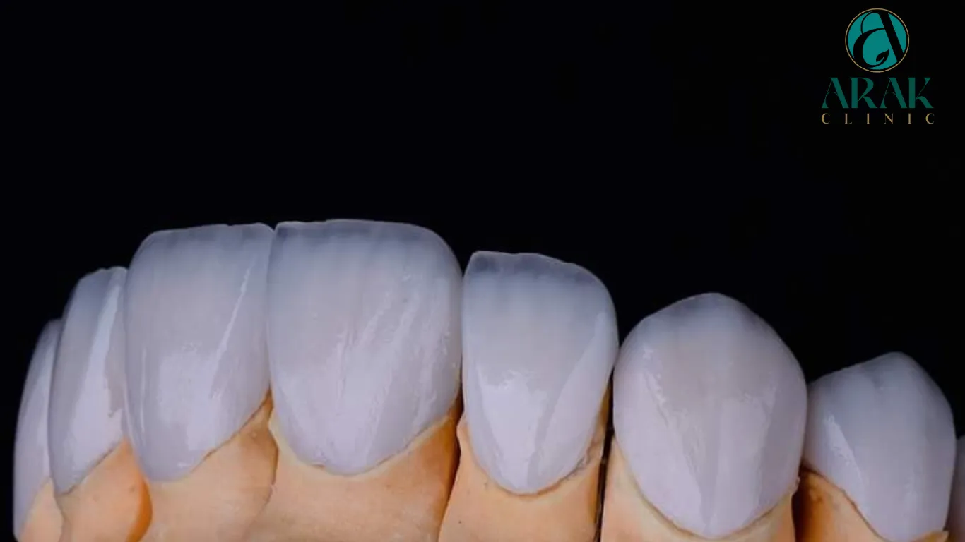 26145 zoom teeth whitening consultation