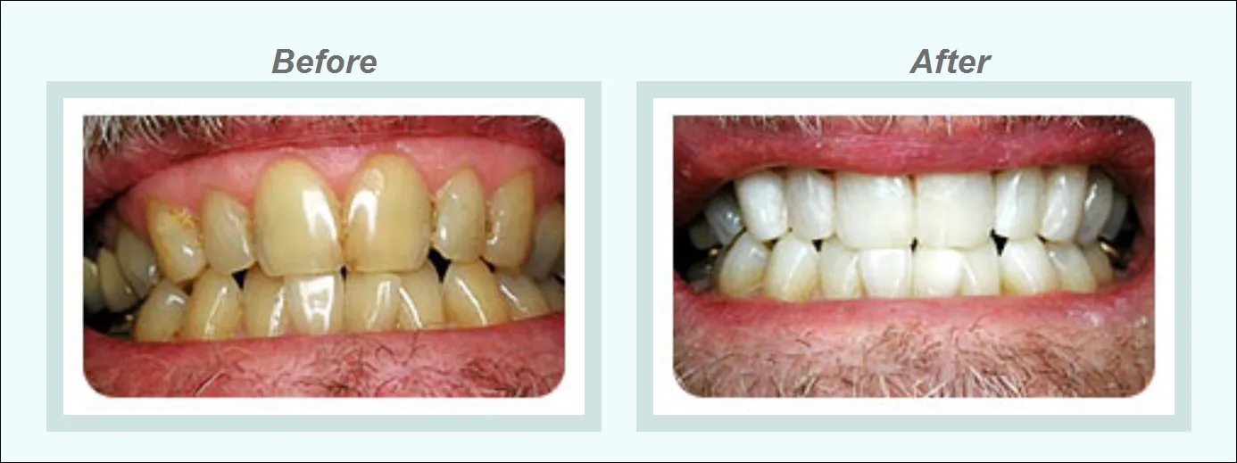 /img/26147-dentist-consultation.webp