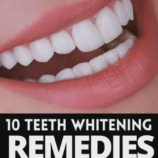 /img/26148-healthy-smile.webp