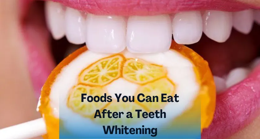 26150 foods avoid teeth whitening