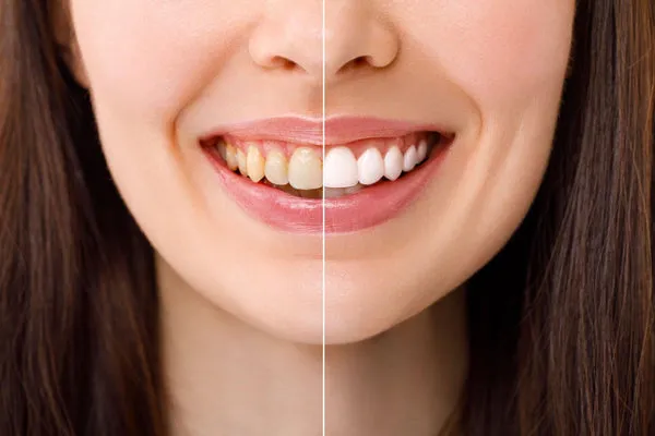 26150 oral hygiene