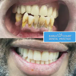 /img/26151-dentist-earls-court.webp