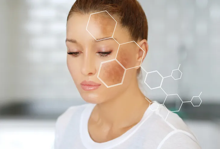 /img/26152-laser-whitening-results.webp