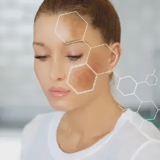 /img/26152-laser-whitening-results.webp