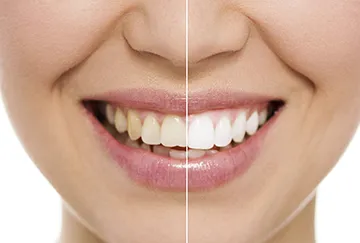 /img/26156-brushing-teeth.webp