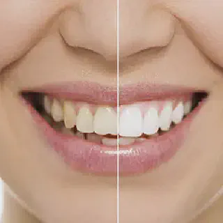 /img/26156-brushing-teeth.webp