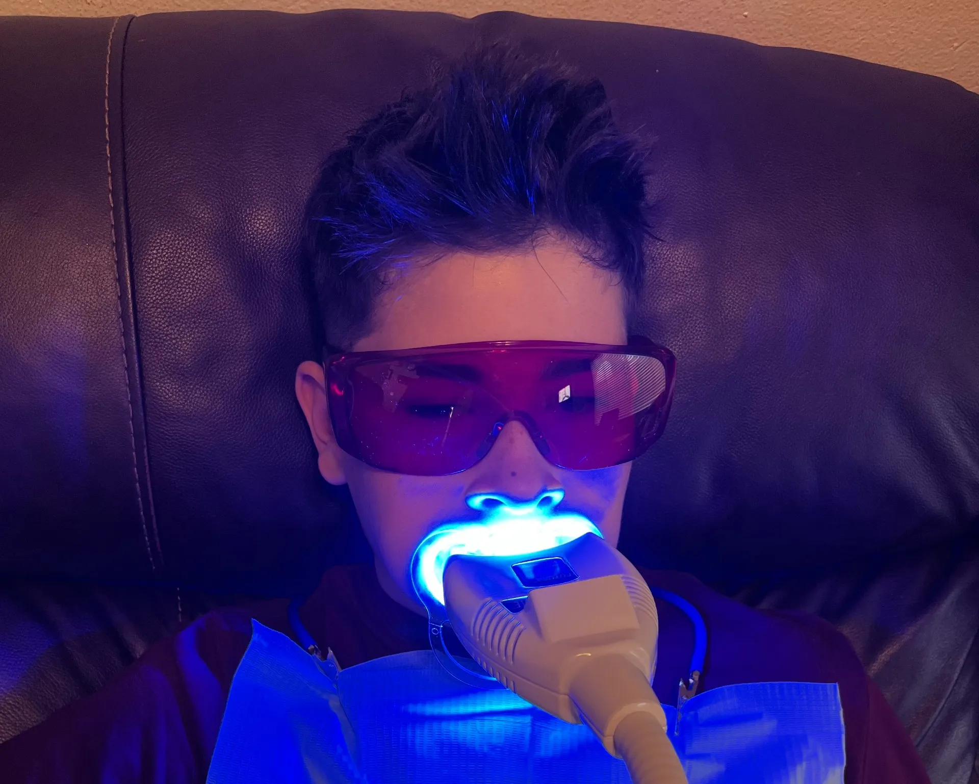 26156 teeth whitening intro