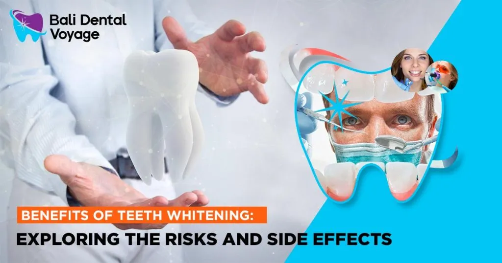 26159 teeth whitening home
