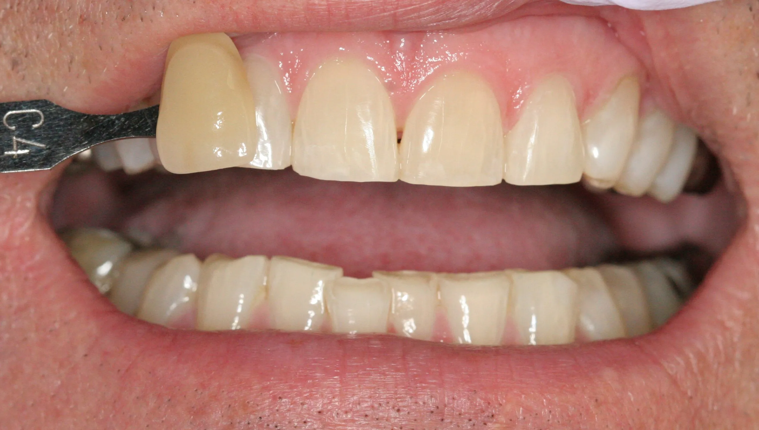 26163 dentist grade whitening oral hygiene
