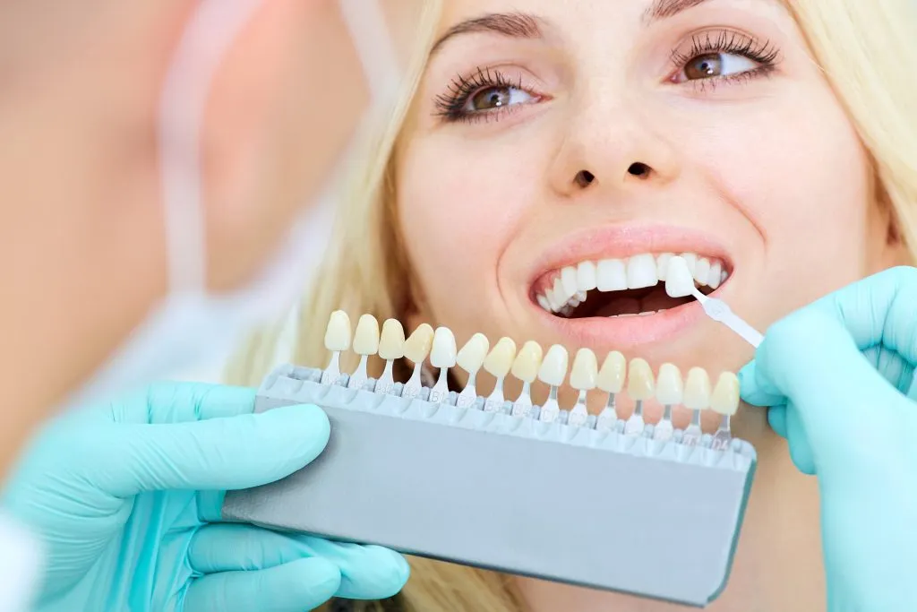 26163 dentist grade whitening procedure