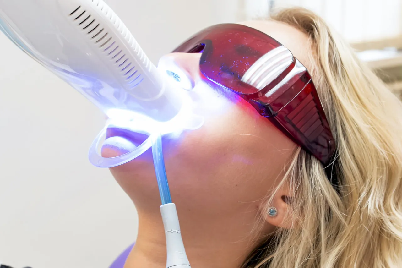 26165 laser whitening teeth safety