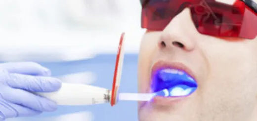 26165 post whitening care