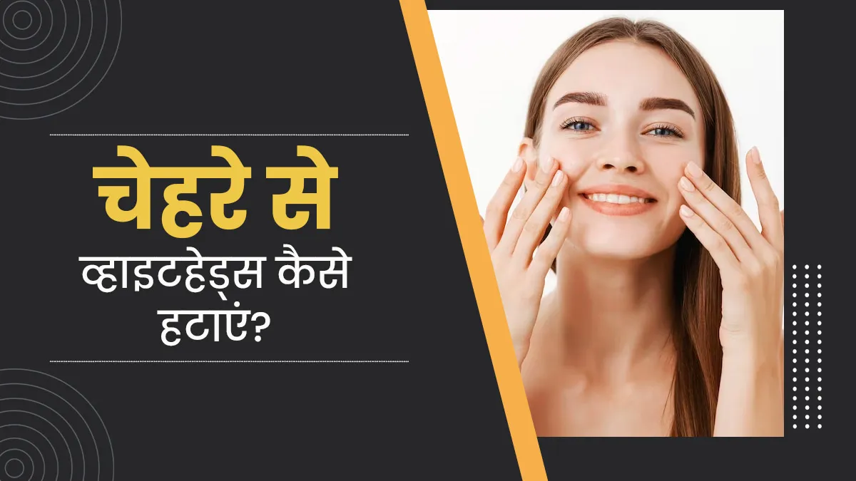 26168 skin tone factors