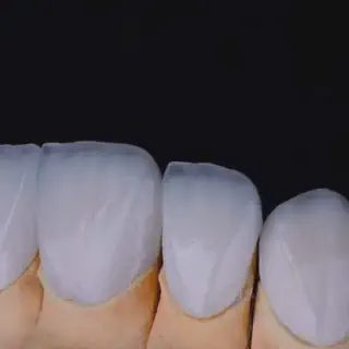 /img/26172-zoom-whitening-pain-8.webp