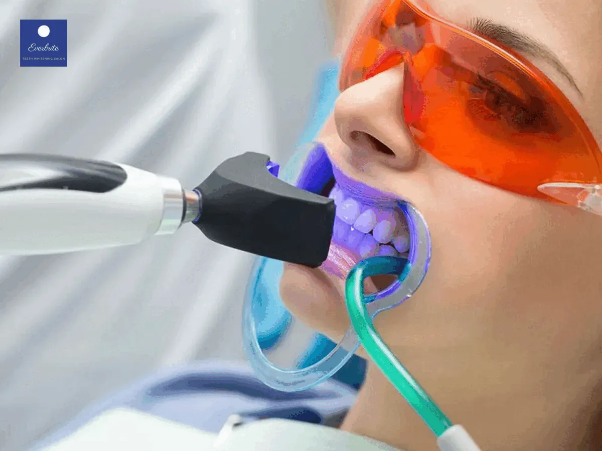 26177 teeth whitening manalapan nj image3