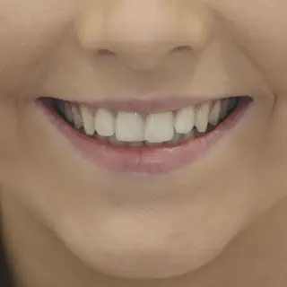 /img/26178-teeth-whitening-confidence.webp