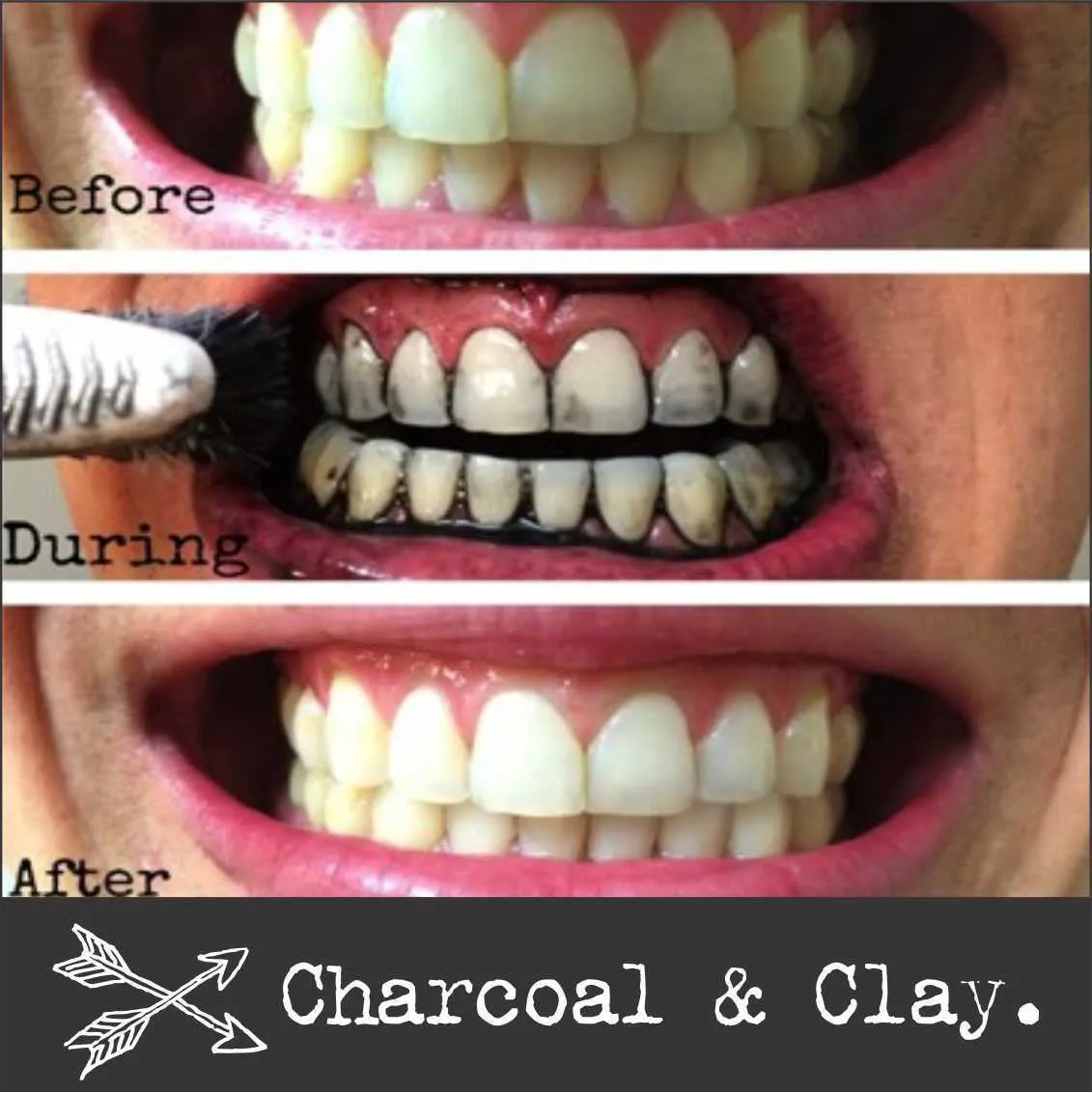 26184 healthy gums