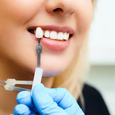 26185 midland teeth whitening at home kit