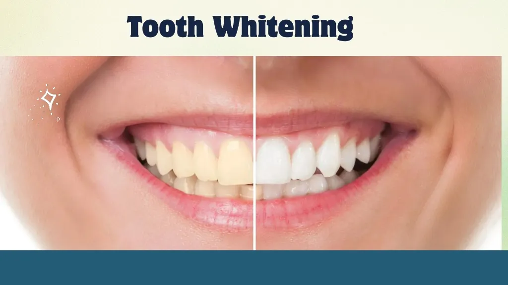 26187 teeth whitening diet