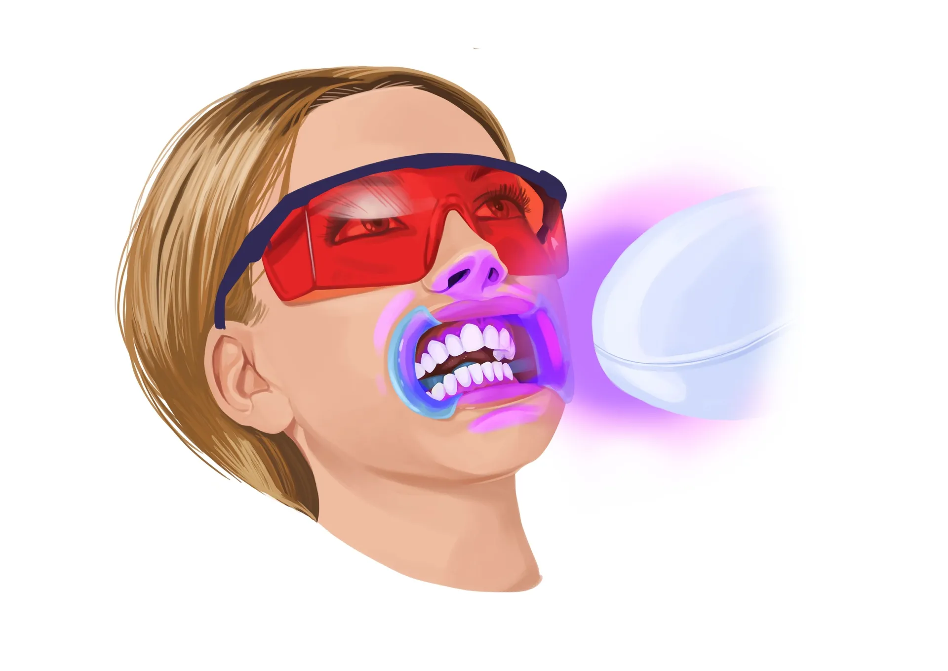 26197 dental whitening comparison