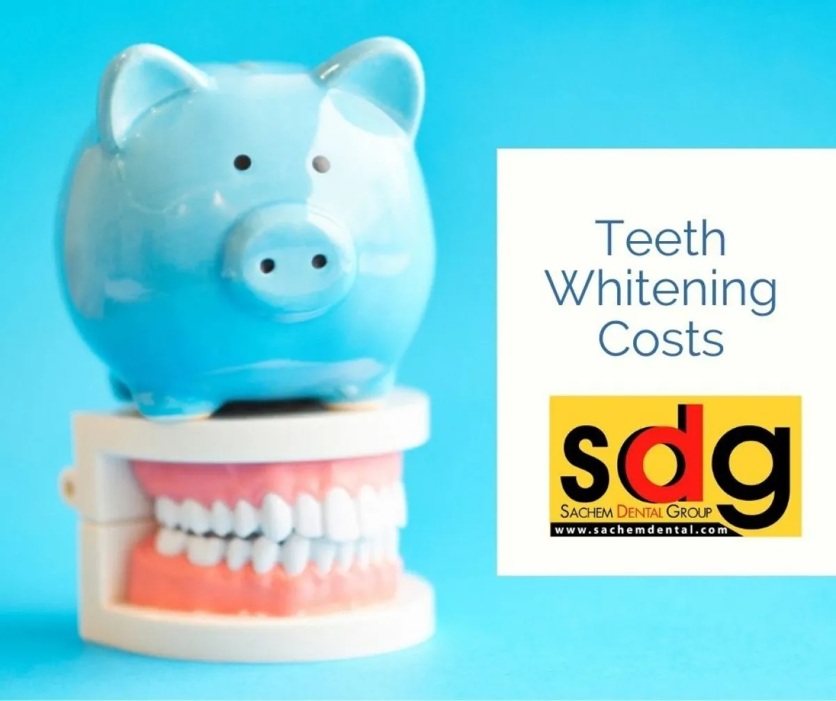 26197 teeth whitening cost factors