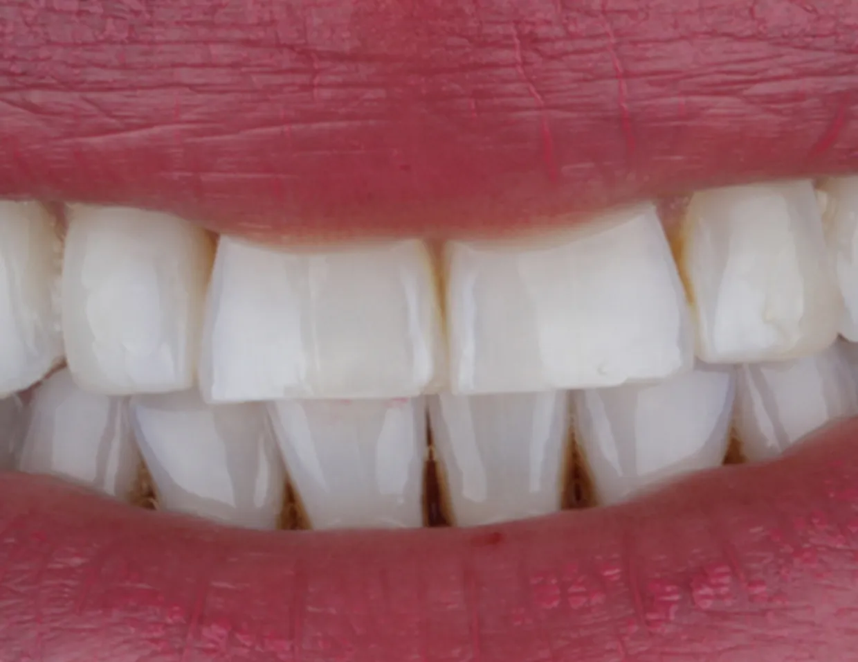 26201 dental professional teeth whitening