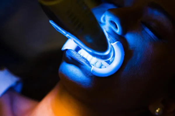 26202 laser teeth whitening sensitivity