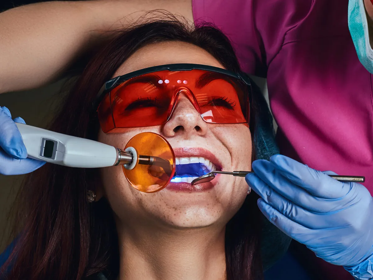 26202 teeth whitening alternatives