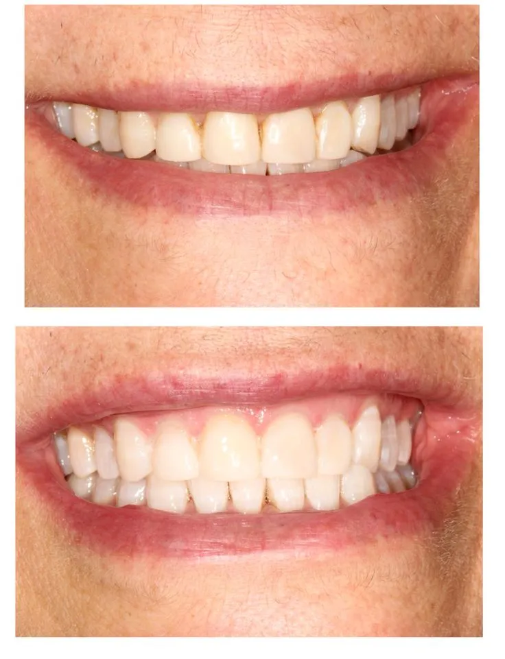 26205 dentist consultation