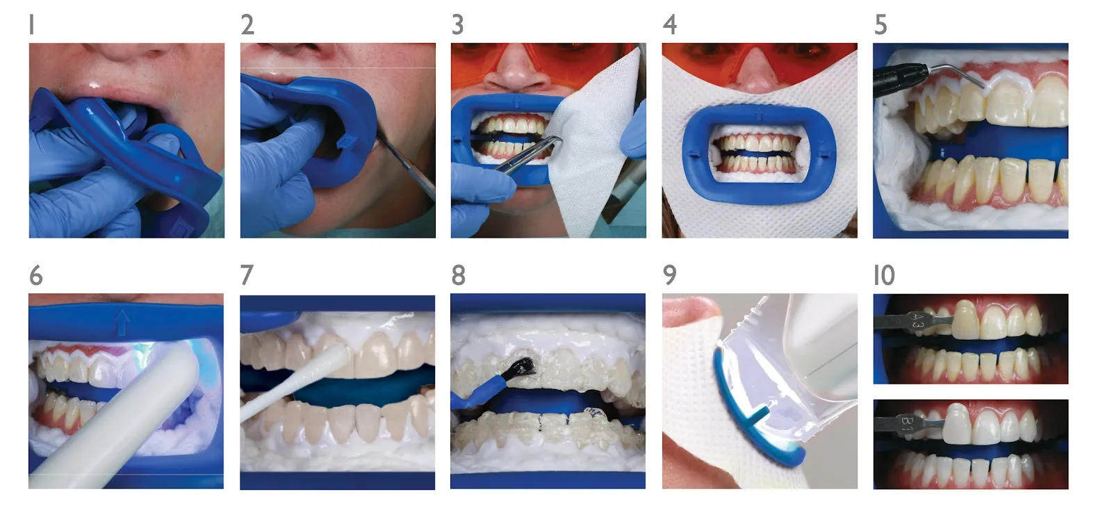 26205 gum protection for whitening